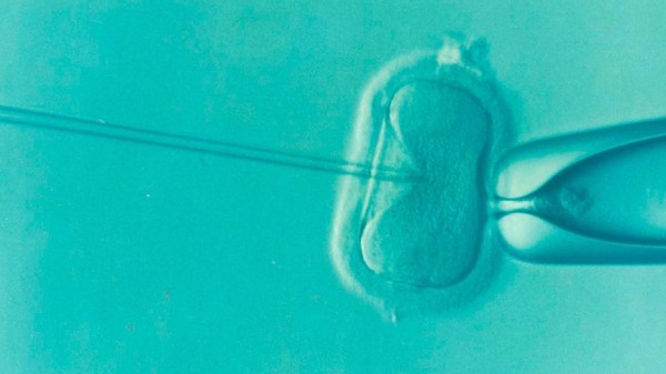 Победить время: что такое отложенное материнство и кому оно подходит Победить время: что такое отложенное материнство и кому оно подходит